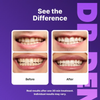 DrDent Peroxide-Free Purple Teeth Whitening Strips